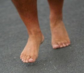 Barefoot Running Injuries and the Evolution of Distance Running in Humans