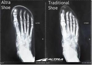 Your Feet in Wide vs. Narrow Shoes: Great Visual From Altra Running!